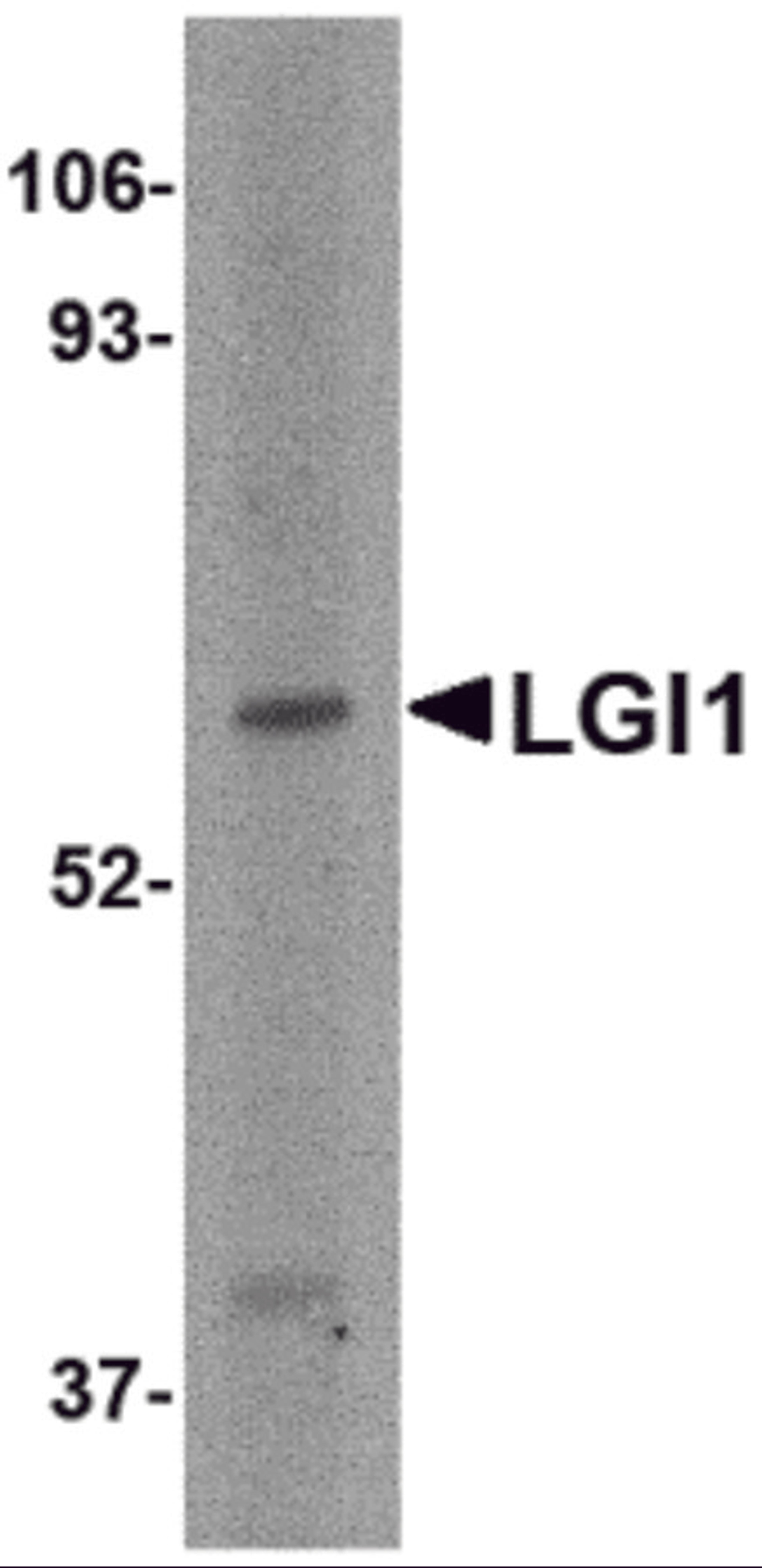 Western blot analysis of LGI1 in HeLa cell lysate with LGI1 antibody at 2 &#956;g/mL.