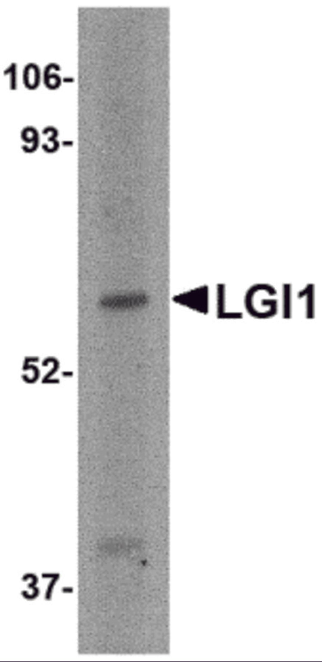Western blot analysis of LGI1 in HeLa cell lysate with LGI1 antibody at 2 μg/mL.