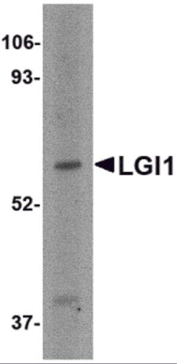 Western blot analysis of LGI1 in HeLa cell lysate with LGI1 antibody at 2 μg/mL.