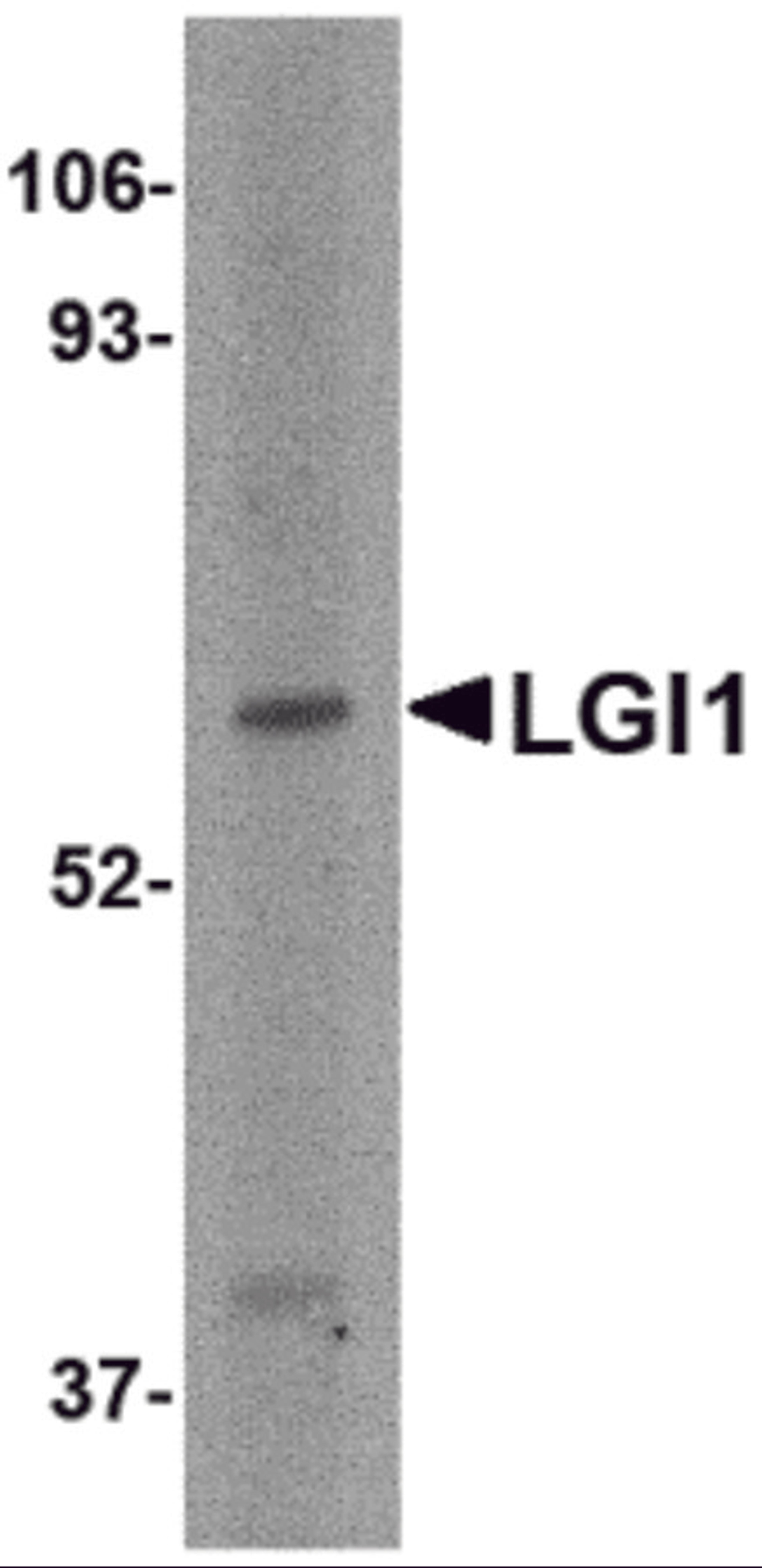 Western blot analysis of LGI1 in HeLa cell lysate with LGI1 antibody at 2 μg/mL.