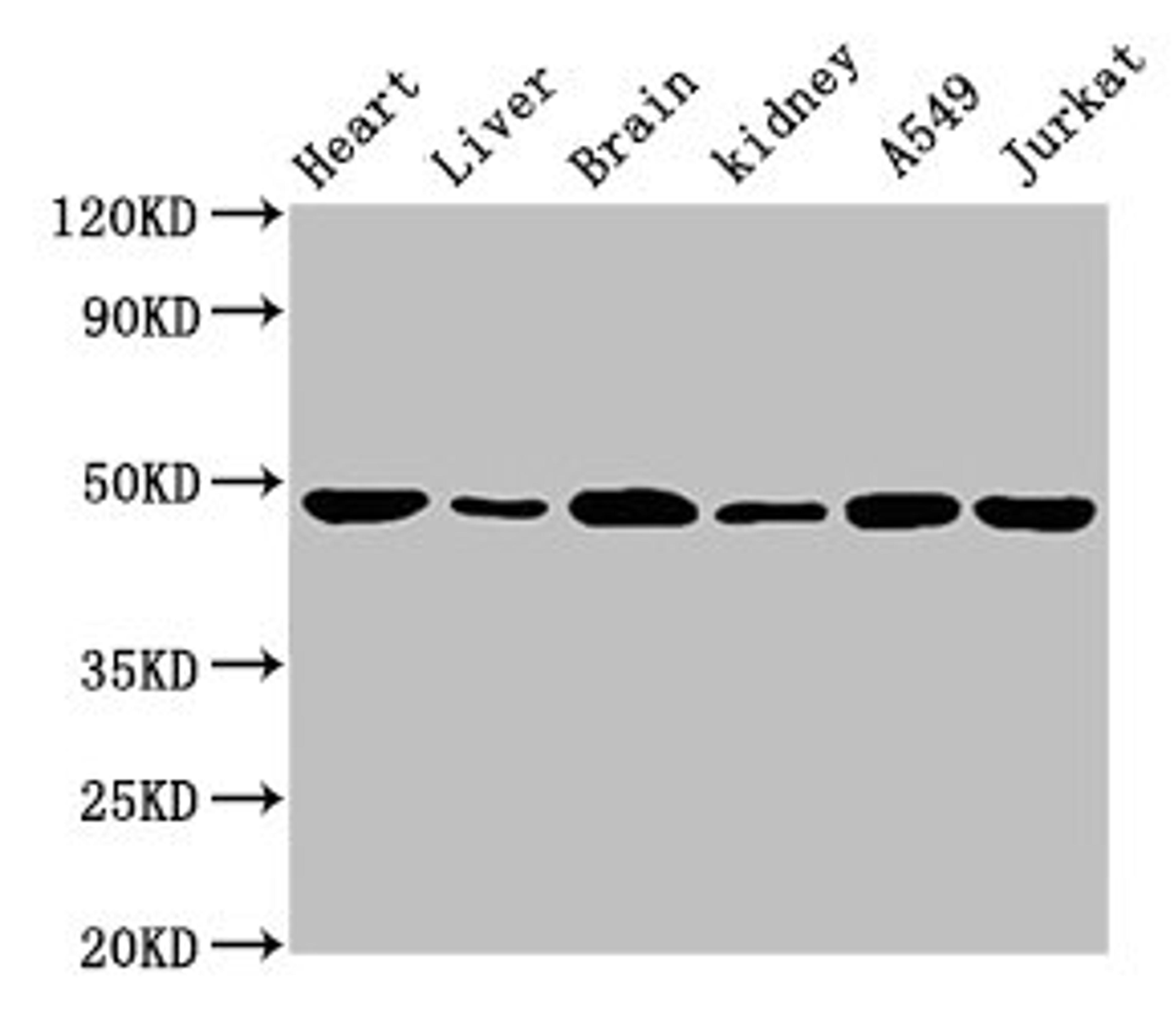 Western Blot. Positive WB detected in: Mouse heart tissue, Mouse liver tissue, Mouse brain tissue, Mouse kidney tissue, A549 whole cell lysate, Jurkat whole cell lysate. All lanes: ENO2 antibody at 1.5µg/ml. Secondary. Goat polyclonal to rabbit IgG at 1/10000 dilution. Predicted band size: 48, 43 kDa. Observed band size: 48 kDa