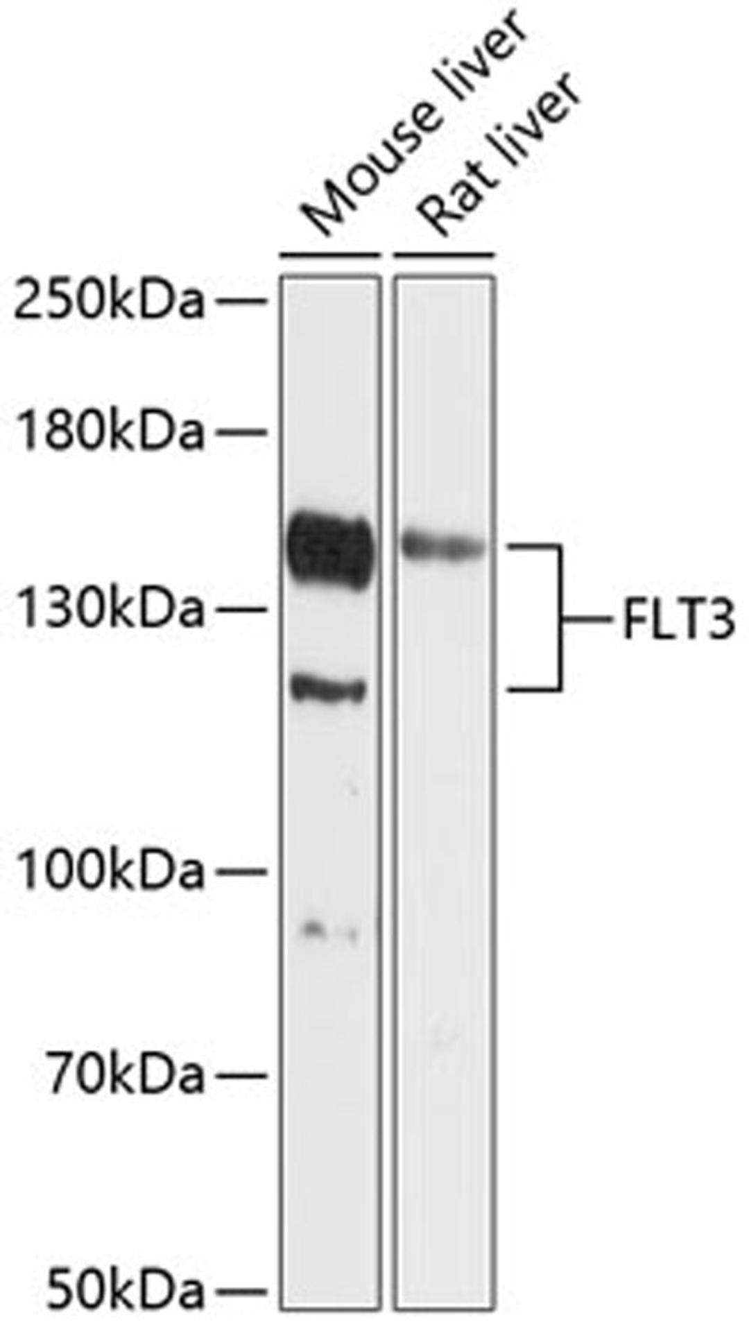 Western blot - FLT3 antibody (A12462)