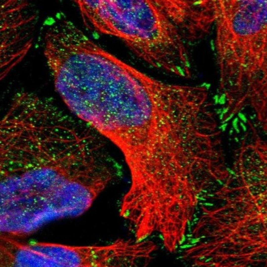 Immunocytochemistry/Immunofluorescence: ASCC2 Antibody [NBP1-88815] - Staining of human cell line U-2 OS shows positivity in nucleus, cytoplasm & focal adhesions.