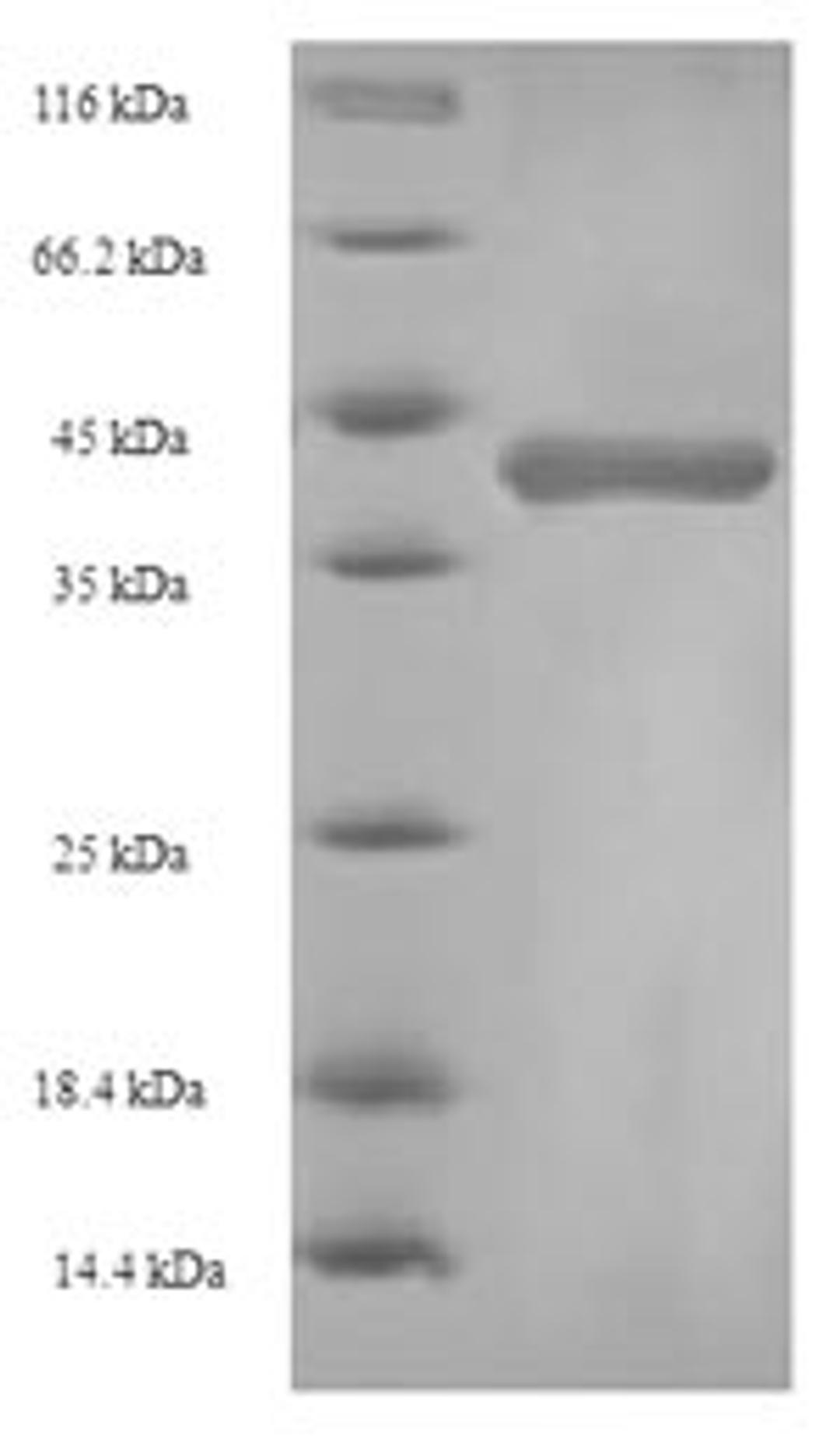 (Tris-Glycine gel) Discontinuous SDS-PAGE (reduced) with 5% enrichment gel and 15% separation gel.