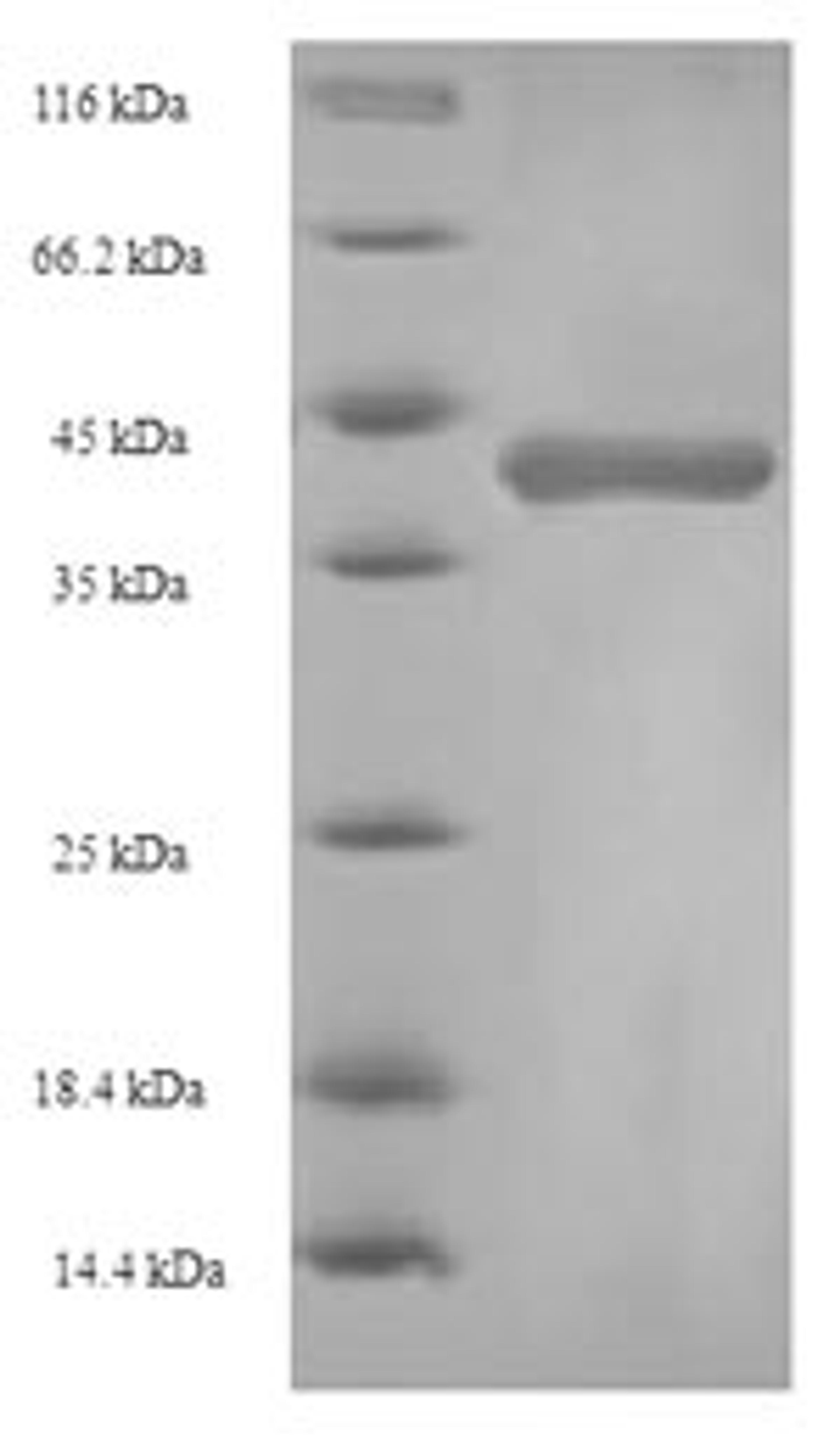 (Tris-Glycine gel) Discontinuous SDS-PAGE (reduced) with 5% enrichment gel and 15% separation gel.