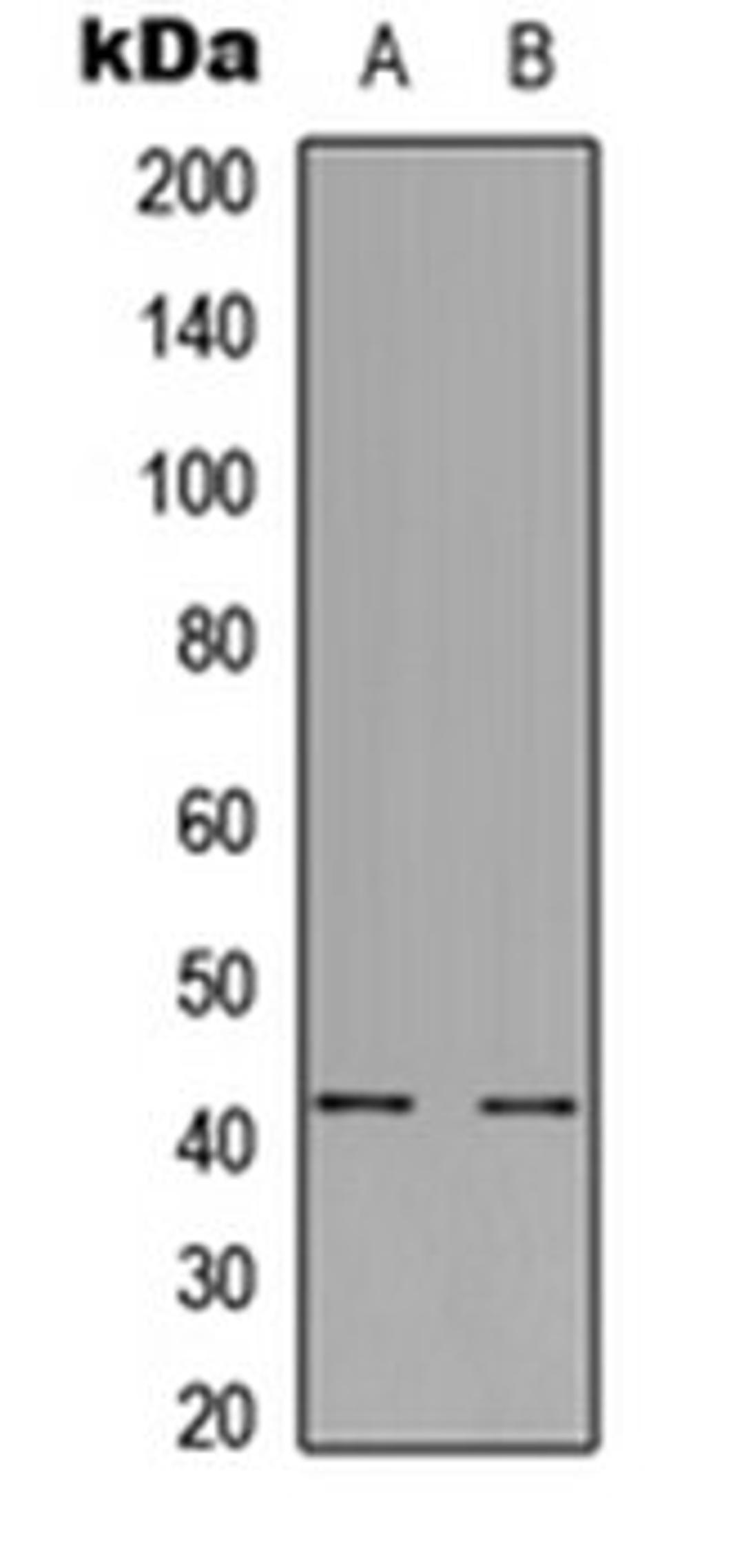 Western blot analysis of A549 (Lane 1), H9C2 (Lane 2) whole cell lysates using GPR85 antibody