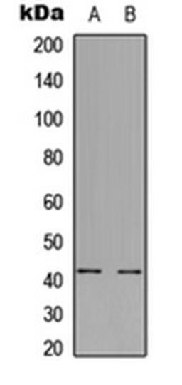 Western blot analysis of A549 (Lane 1), H9C2 (Lane 2) whole cell lysates using GPR85 antibody