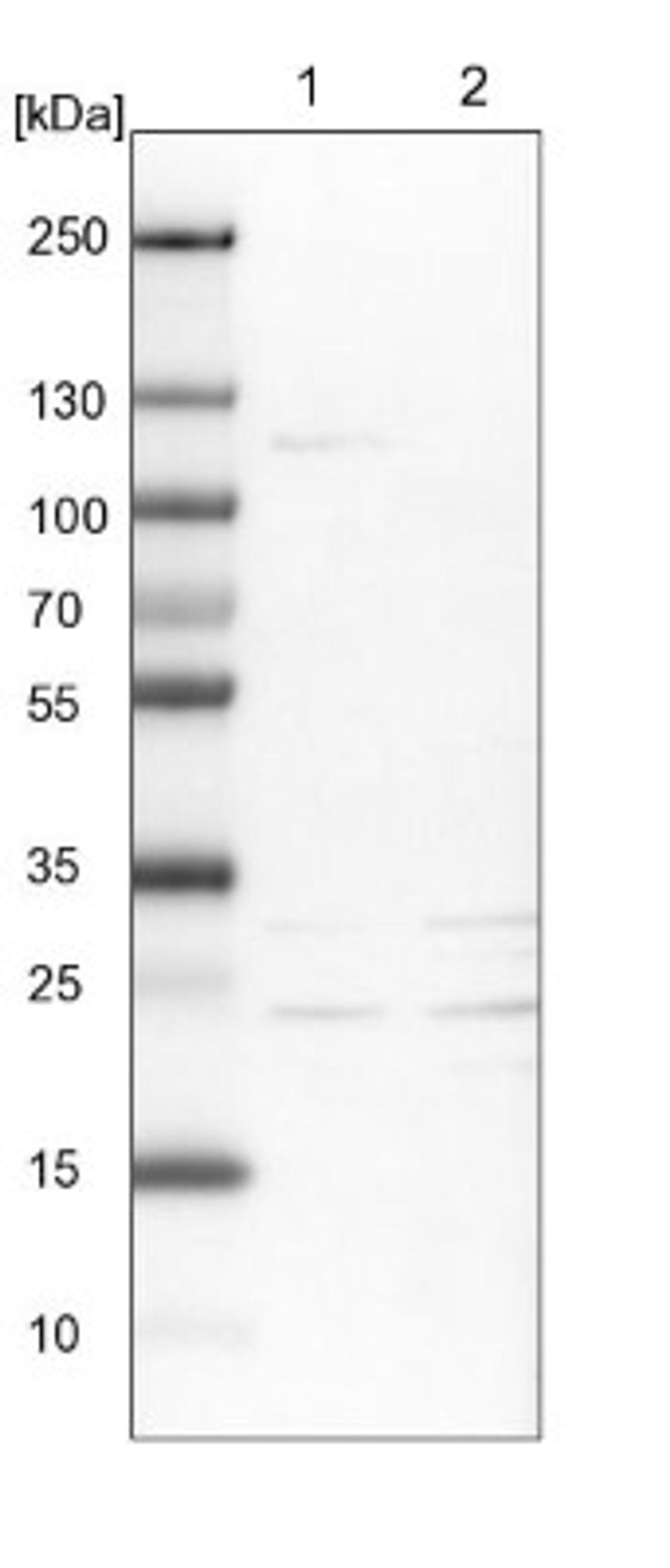 Western Blot: MOSPD1 Antibody [NBP1-84220] - Lane 1: NIH-3T3 cell lysate (Mouse embryonic fibroblast cells)<br/>Lane 2: NBT-II cell lysate (Rat Wistar bladder tumour cells)