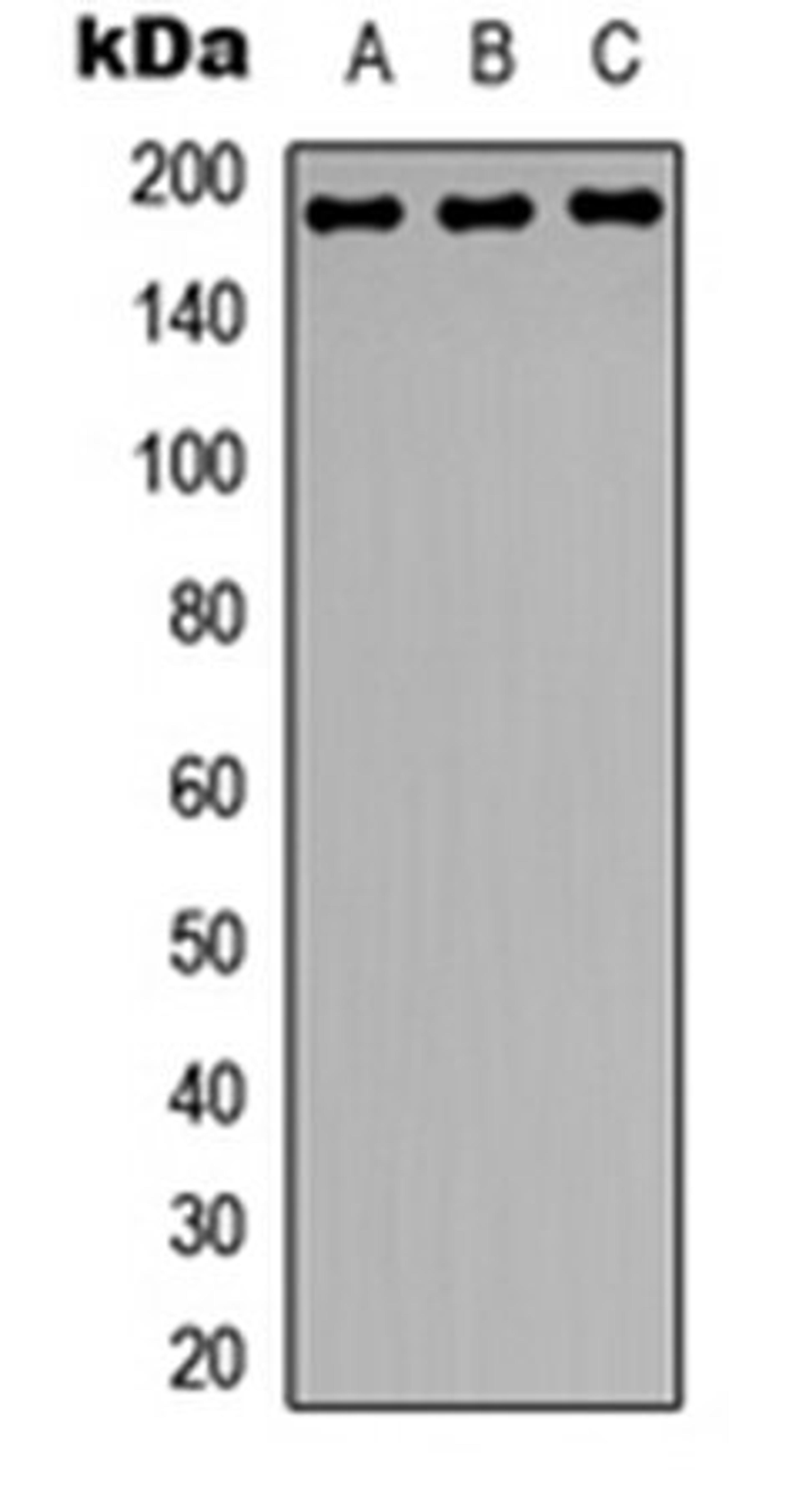 Western blot analysis of HeLa (Lane 1), NIH3T3 (Lane 2), rat brain (Lane 3) whole cell lysates using Zep-1 antibody