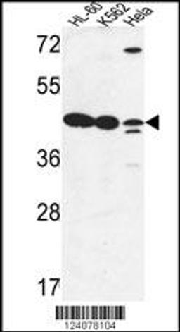 Western blot analysis in HL-60,K562,Hela cell line lysates (35ug/lane).