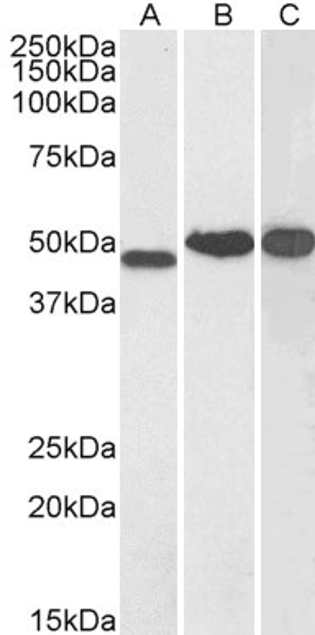 45-938 (0.1ug/ml) staining of Human Kidney (A), Cerebellum (B) and Testis (C) lysate (35ug protein in RIPA buffer). Primary incubation was 1 hour. Detected by chemiluminescence.