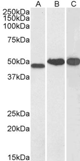 45-938 (0.1ug/ml) staining of Human Kidney (A), Cerebellum (B) and Testis (C) lysate (35ug protein in RIPA buffer). Primary incubation was 1 hour. Detected by chemiluminescence.