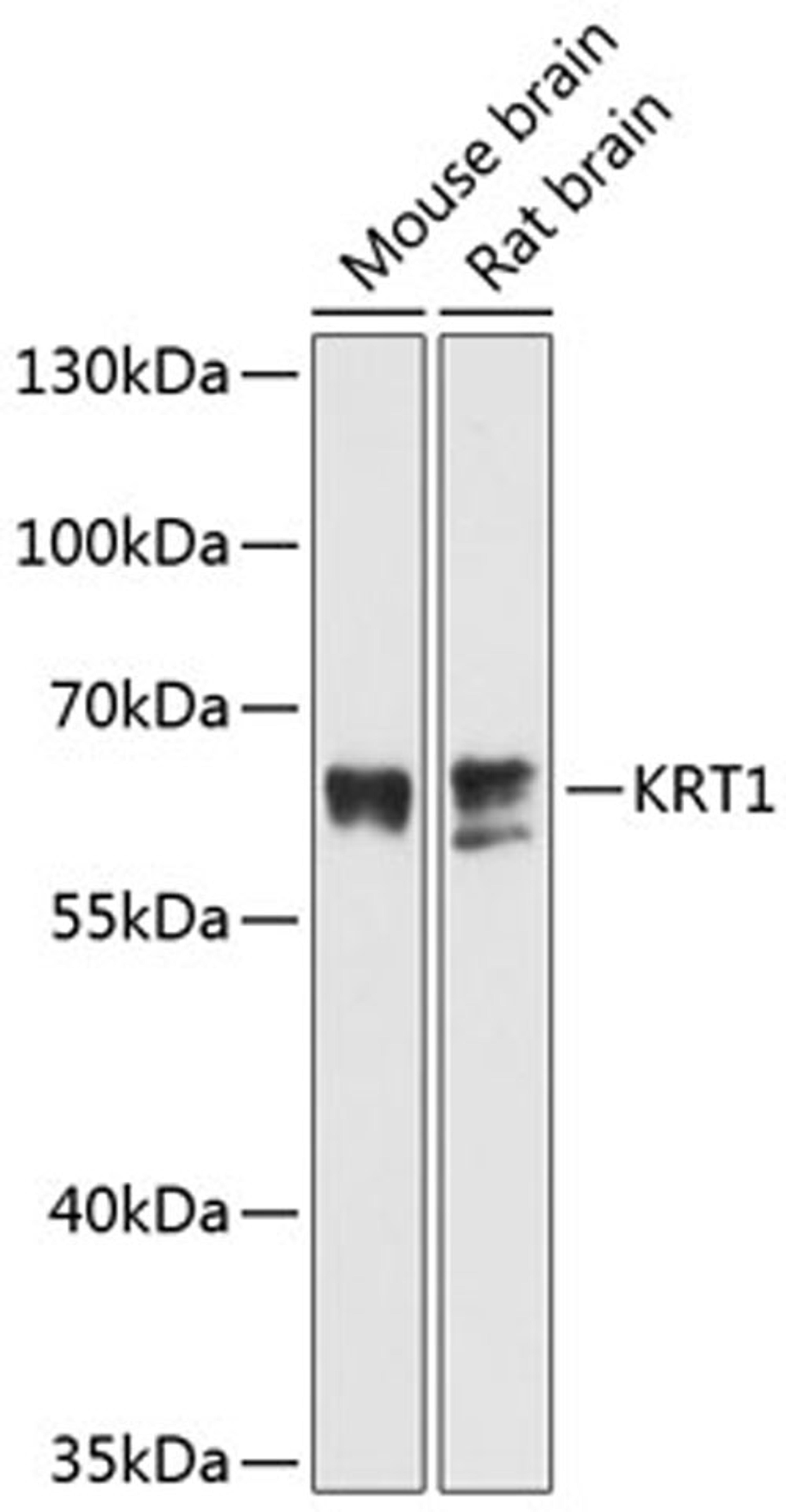 Western blot - KRT1 antibody (A11958)