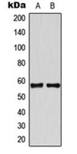 Western blot analysis of HeLa (Lane 1), Jurkat (Lane 2) whole cell lysates using TBX22 antibody