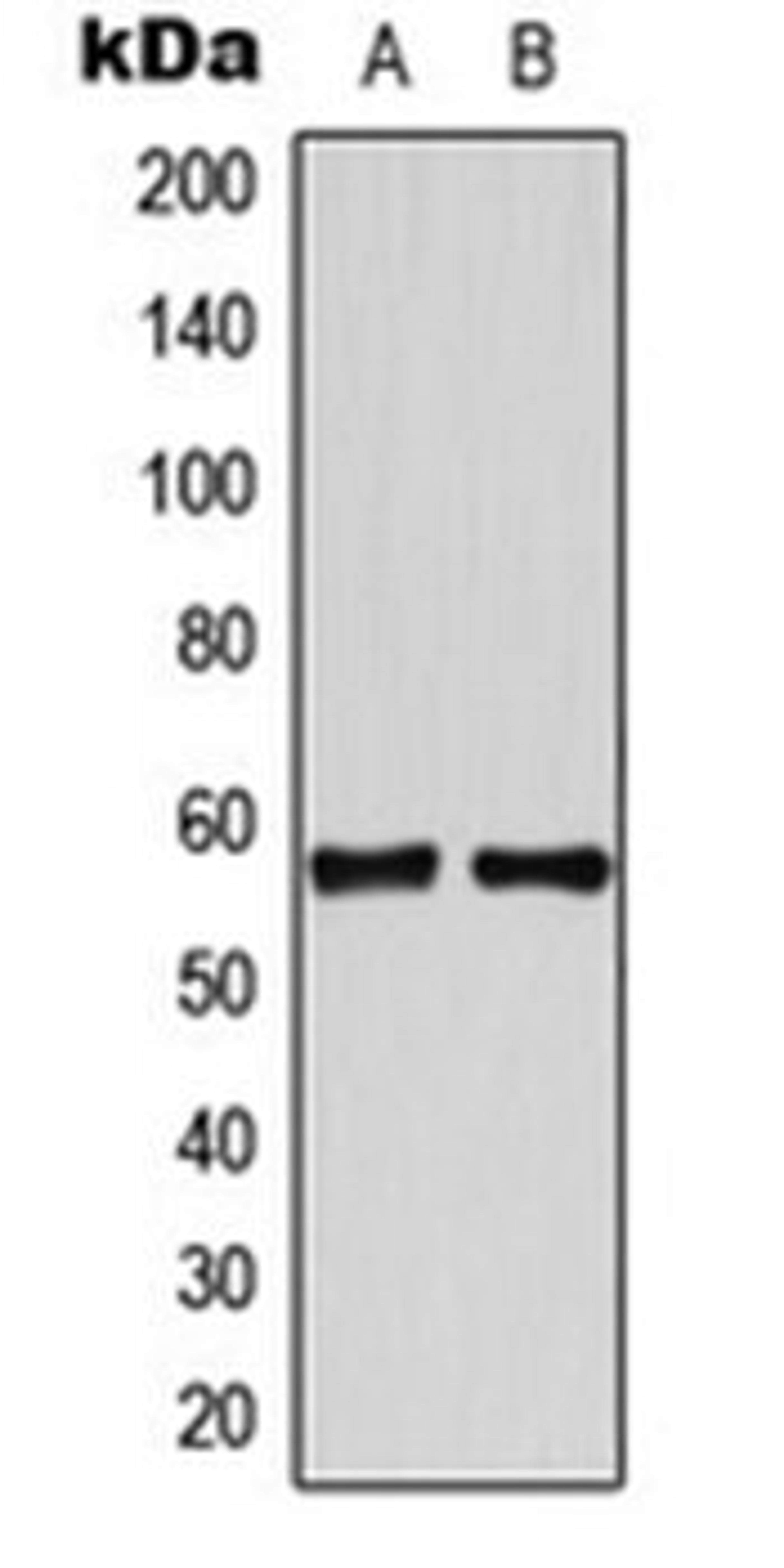 Western blot analysis of HeLa (Lane 1), Jurkat (Lane 2) whole cell lysates using TBX22 antibody