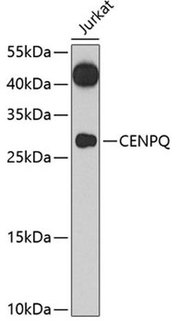 Western blot - CENPQ antibody (A7628)