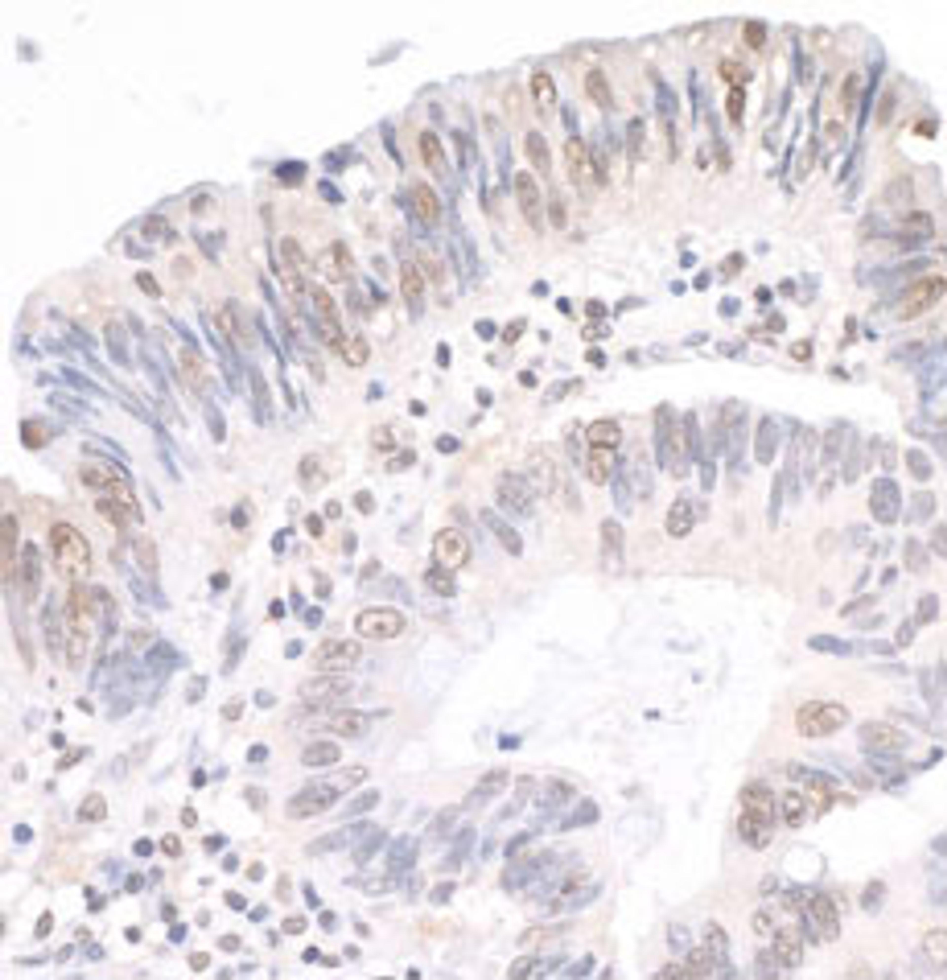 Detection of human MYBBP1A by immunohistochemistry.