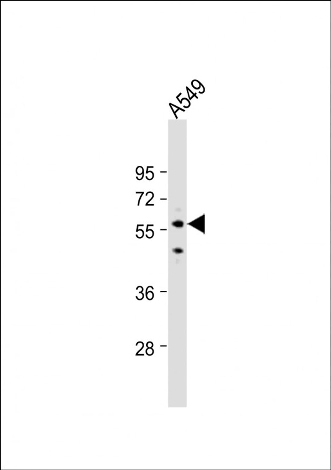 Western Blot at 1:1000 dilution + A549 whole cell lysate Lysates/proteins at 20 ug per lane.