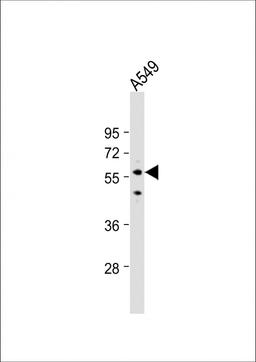 Western Blot at 1:1000 dilution + A549 whole cell lysate Lysates/proteins at 20 ug per lane.