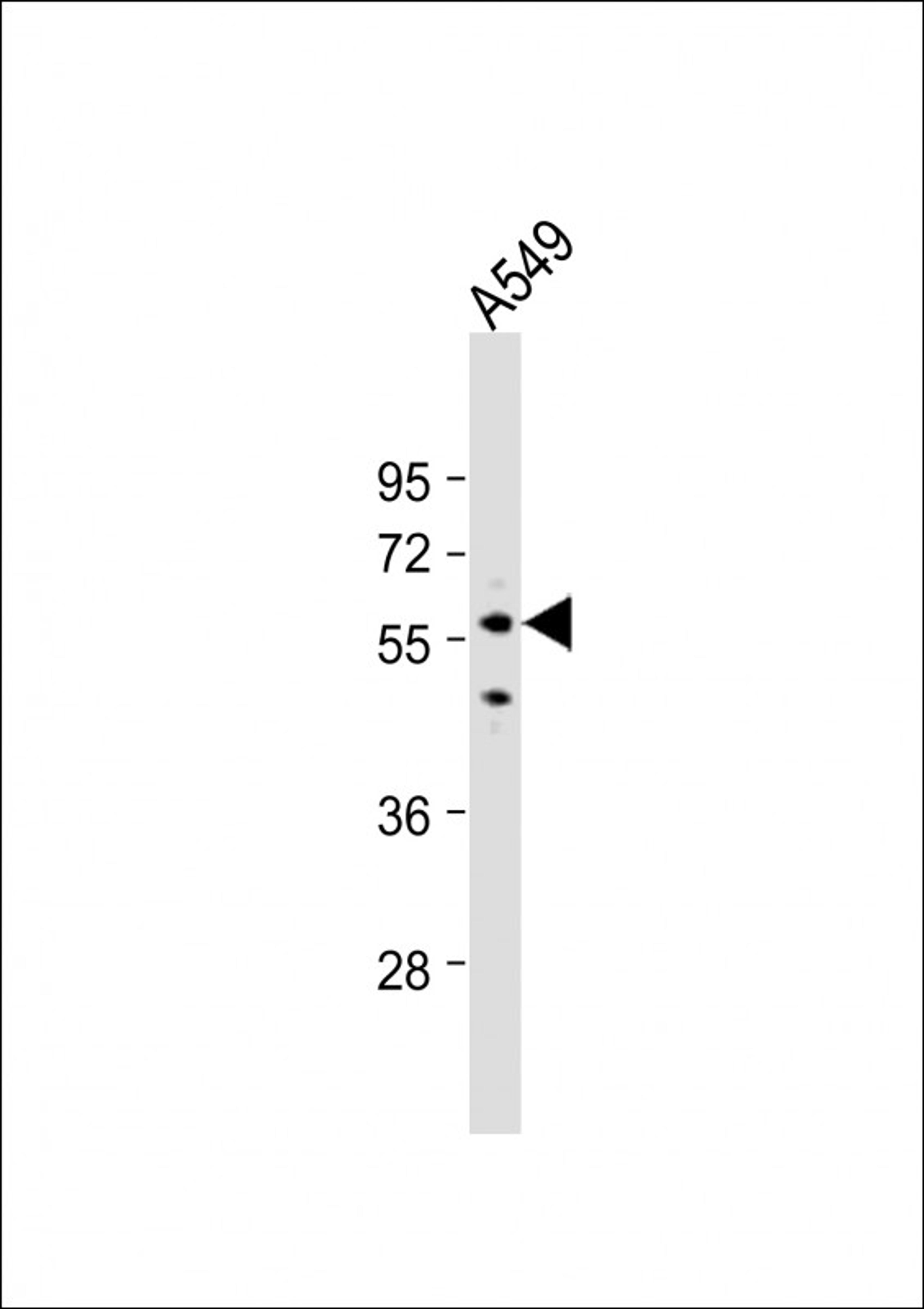 Western Blot at 1:1000 dilution + A549 whole cell lysate Lysates/proteins at 20 ug per lane.