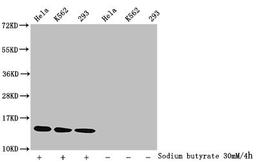 Western Blot. Detected samples: Hela whole cell lysate, K562 whole cell lysate, 293 whole cell lysate; Untreated (-) or treated (+) with 30mM sodium butyrate for 4h. All lanes: HIST1H2BC antibody at 1:1000. Secondary. Goat polyclonal to rabbit IgG at 1/40000 dilution. Predicted band size: 14 kDa. Observed band size: 14 kDa