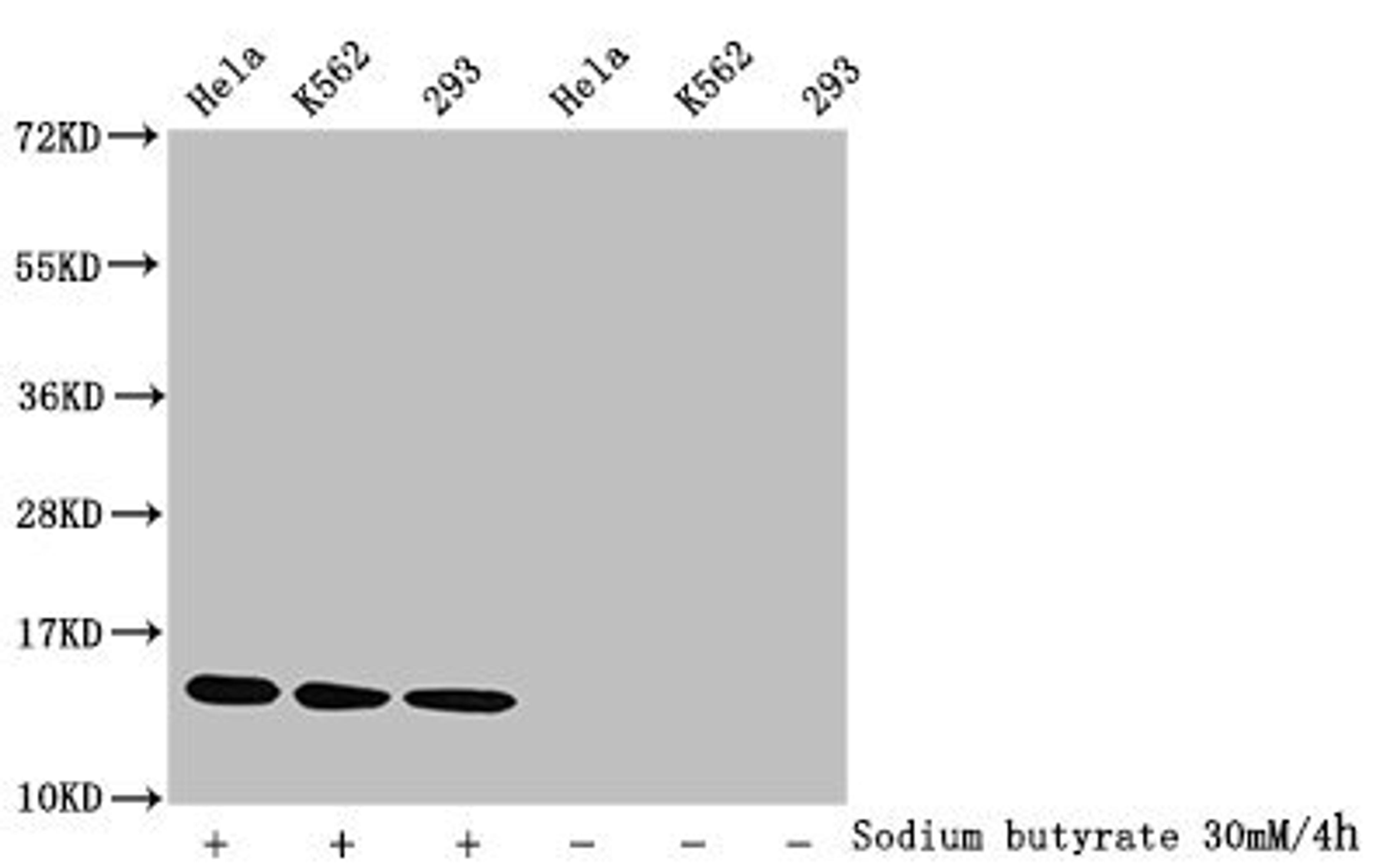 Western Blot. Detected samples: Hela whole cell lysate, K562 whole cell lysate, 293 whole cell lysate; Untreated (-) or treated (+) with 30mM sodium butyrate for 4h. All lanes: HIST1H2BC antibody at 1:1000. Secondary. Goat polyclonal to rabbit IgG at 1/40000 dilution. Predicted band size: 14 kDa. Observed band size: 14 kDa