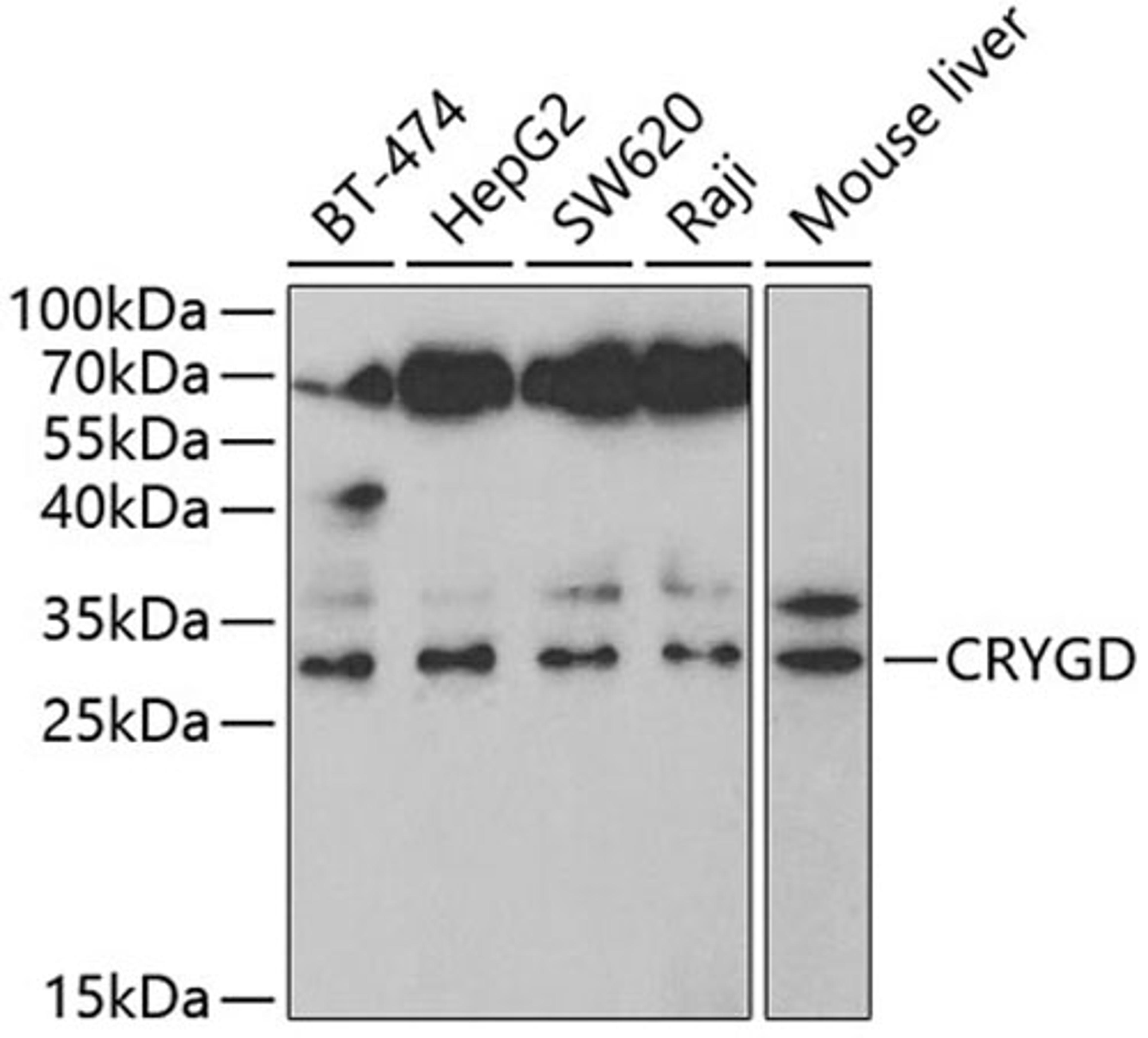 Western blot - CRYGD antibody (A5740)