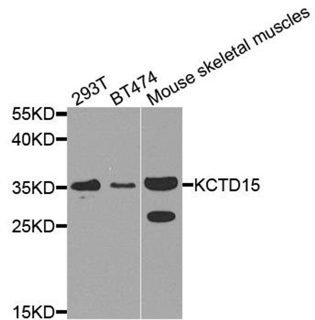 Western blot analysis of extract of various cells using KCTD15 antibody