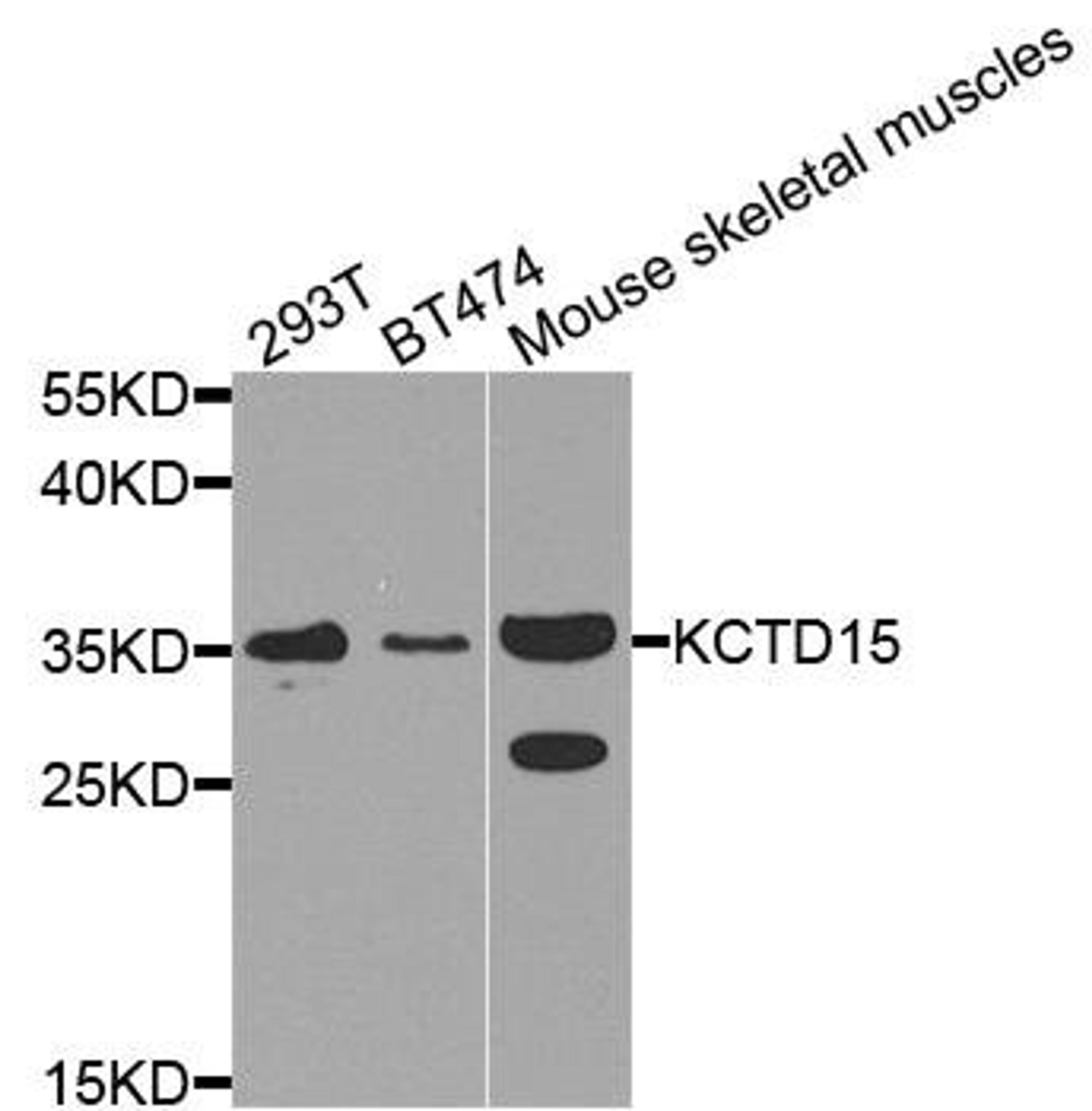 Western blot analysis of extract of various cells using KCTD15 antibody