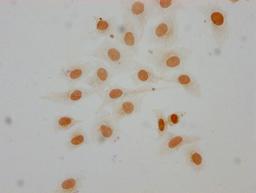 Immunocytochemistry analysis of CSB-PA010379OA16me1HU diluted at 1:25 and staining in Hela cells performed on a Leica BondTM system. The cells were fixed in 4% formaldehyde, permeabilized using 0.2% Triton X-100 and blocked with 10% normal goat serum 30min at RT. Then primary antibody (1% BSA) was incubated at 4°C overnight. The primary is detected by a biotinylated secondary antibody and visualized using an HRP conjugated SP system.