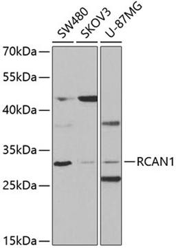 Western blot - RCAN1 antibody (A5326)