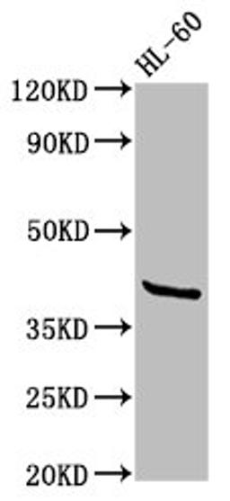 Western Blot. Positive WB detected in: HL60 whole cell lysate. All lanes: GPR32 antibody at 2.6µg/ml. Secondary. Goat polyclonal to rabbit IgG at 1/50000 dilution. Predicted band size: 41 kDa. Observed band size: 41 kDa