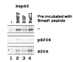 Western blot analysis of whole cell lysates from human hepatoma using SMAD1 (phospho-S206) antibody