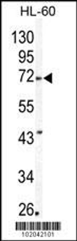 Western blot analysis of MMP24 Antibody in HL60 cell line lysates (35ug/lane)