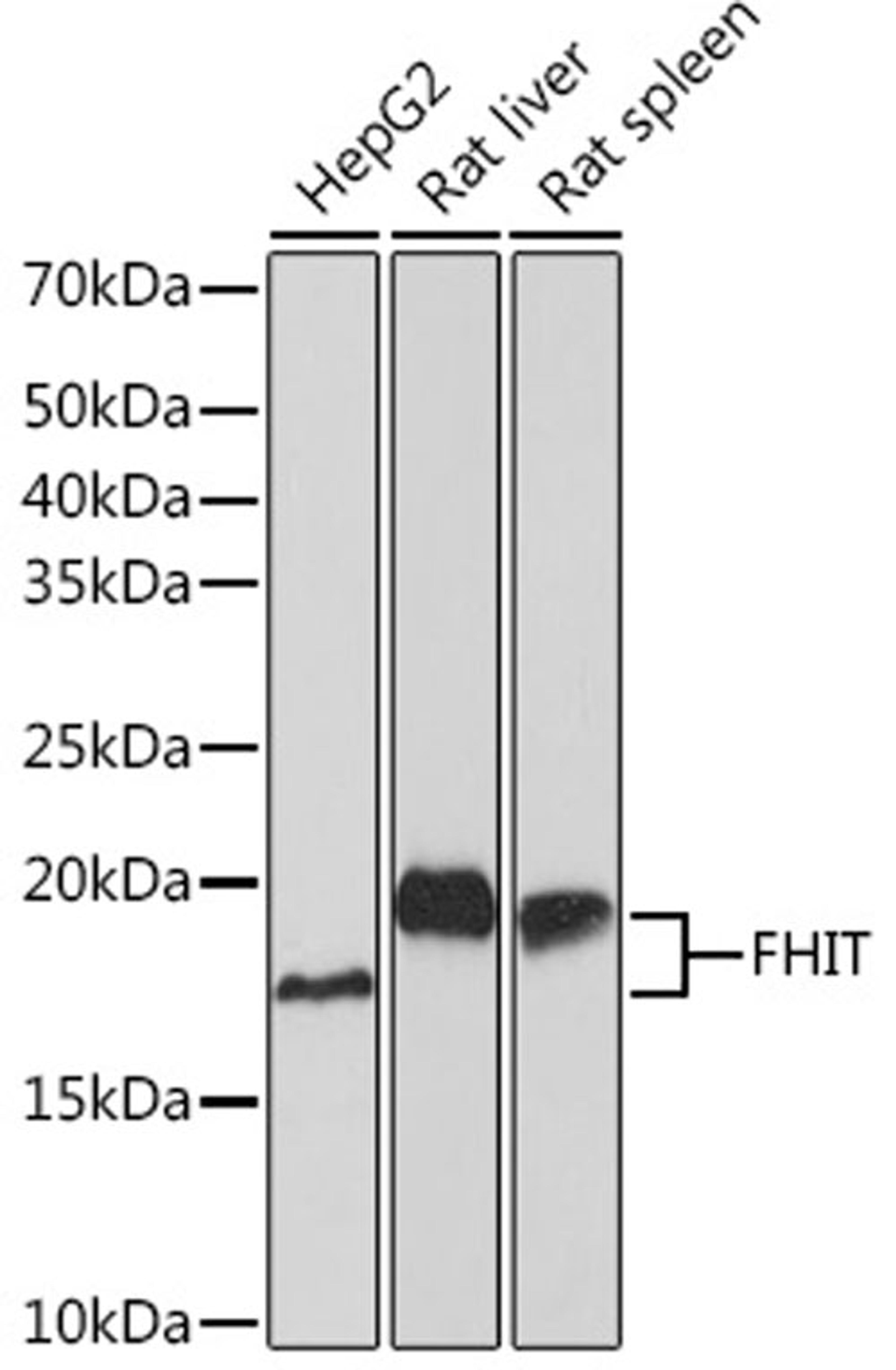 Western blot - FHIT Rabbit mAb (A9072)