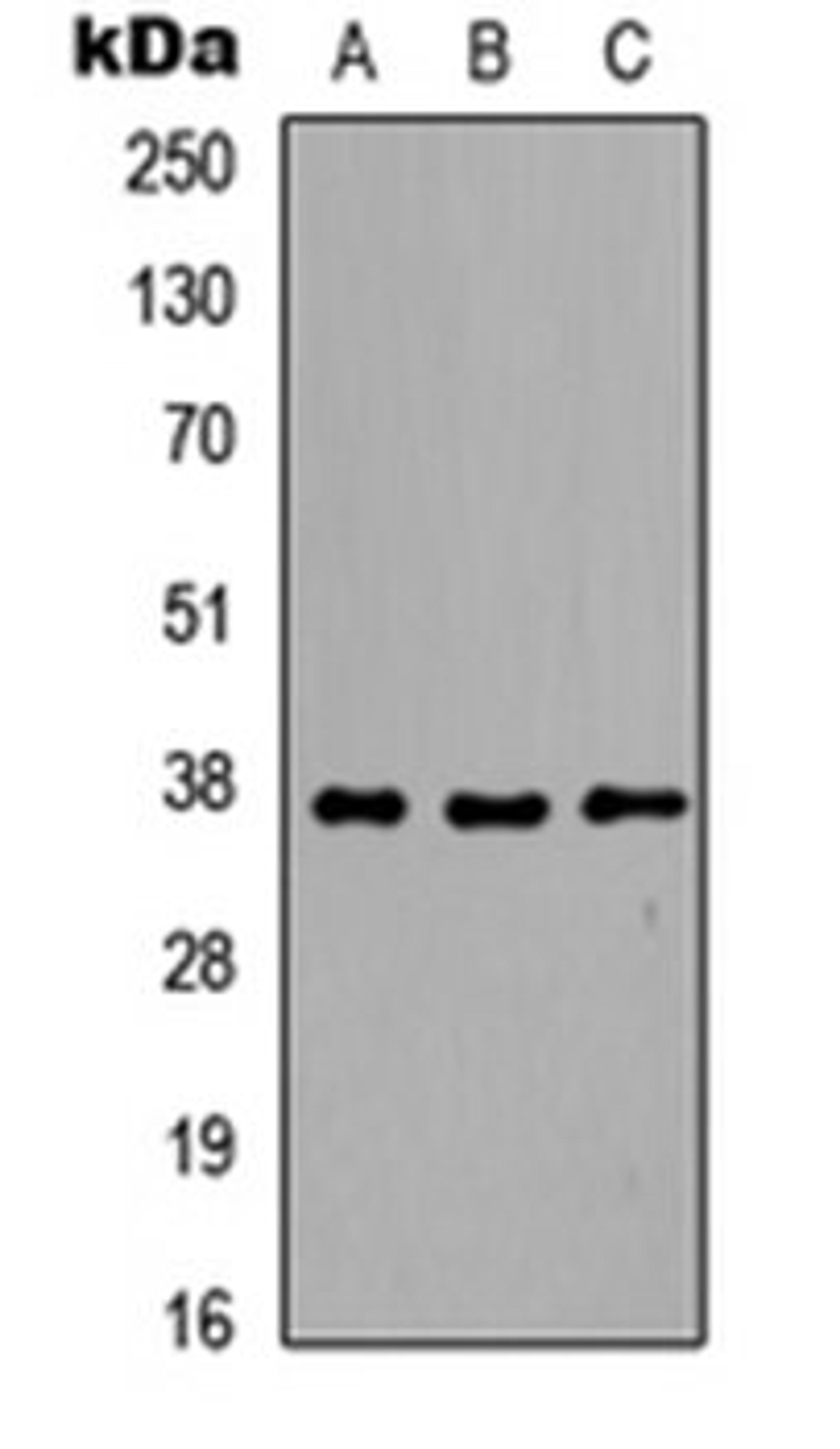 Western blot analysis of HEK293T (Lane 1), Raw264.7 (Lane 2), H9C2 (Lane 3) whole cell lysates using EB2 antibody