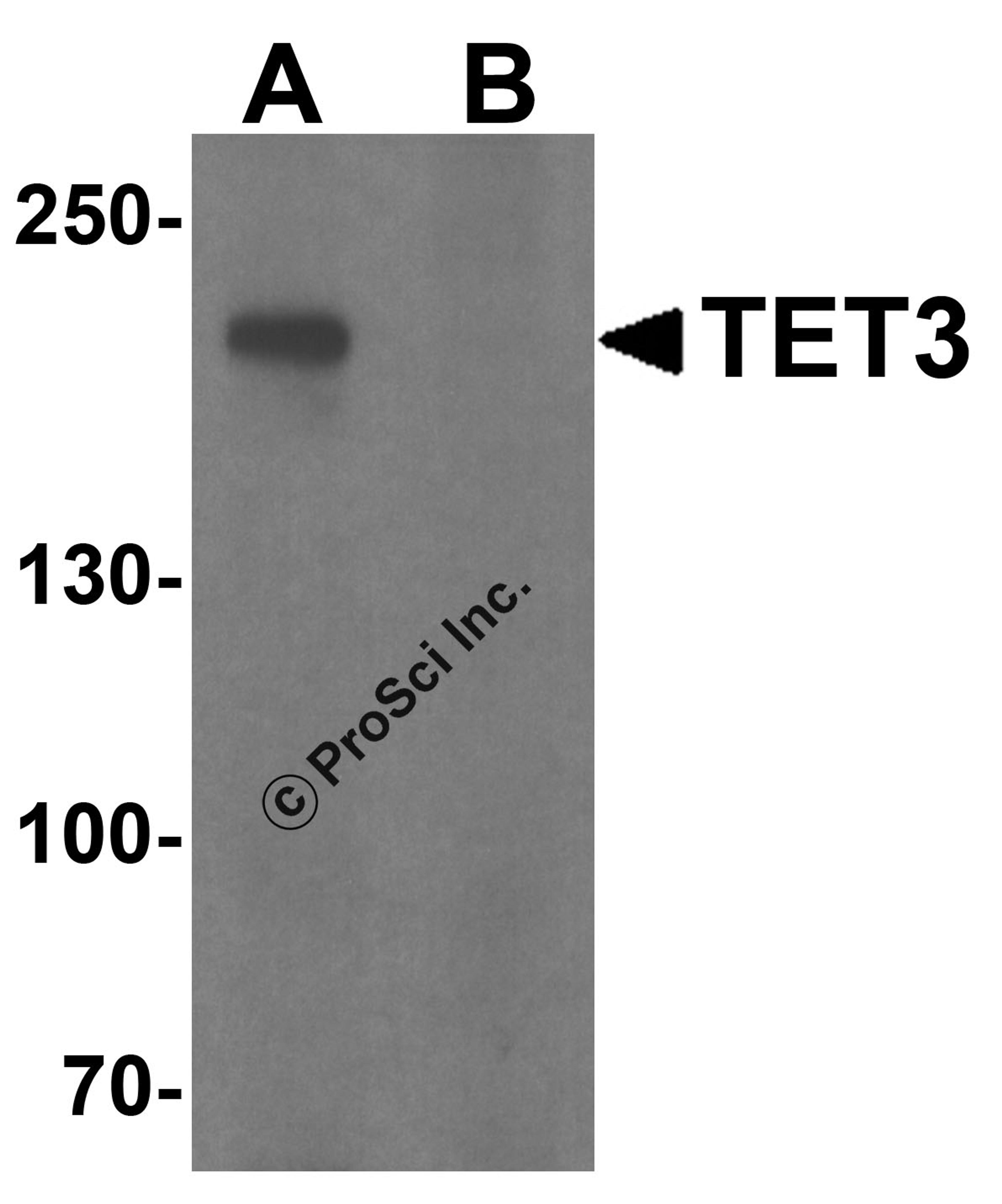 Western blot analysis of TET3 in SK-N-SH cell lysate with TET3 antibody at 1 μg/ml in (A) the absence and (B) the presence of blocking peptide.