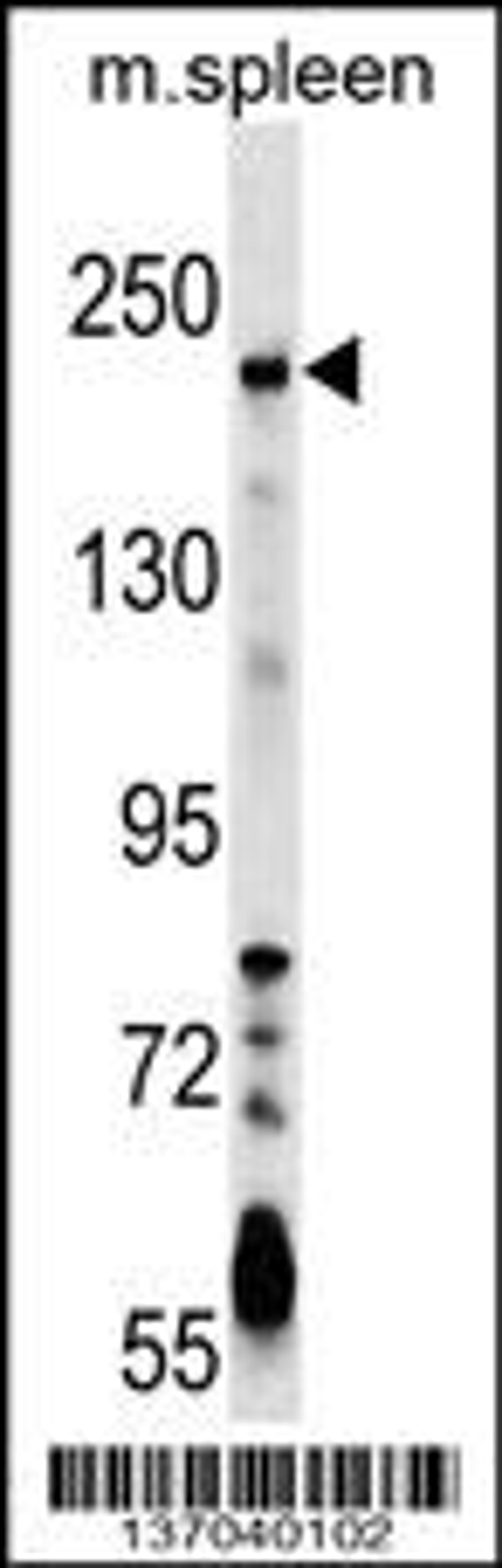 Western blot analysis in mouse spleen tissue lysates (35ug/lane).