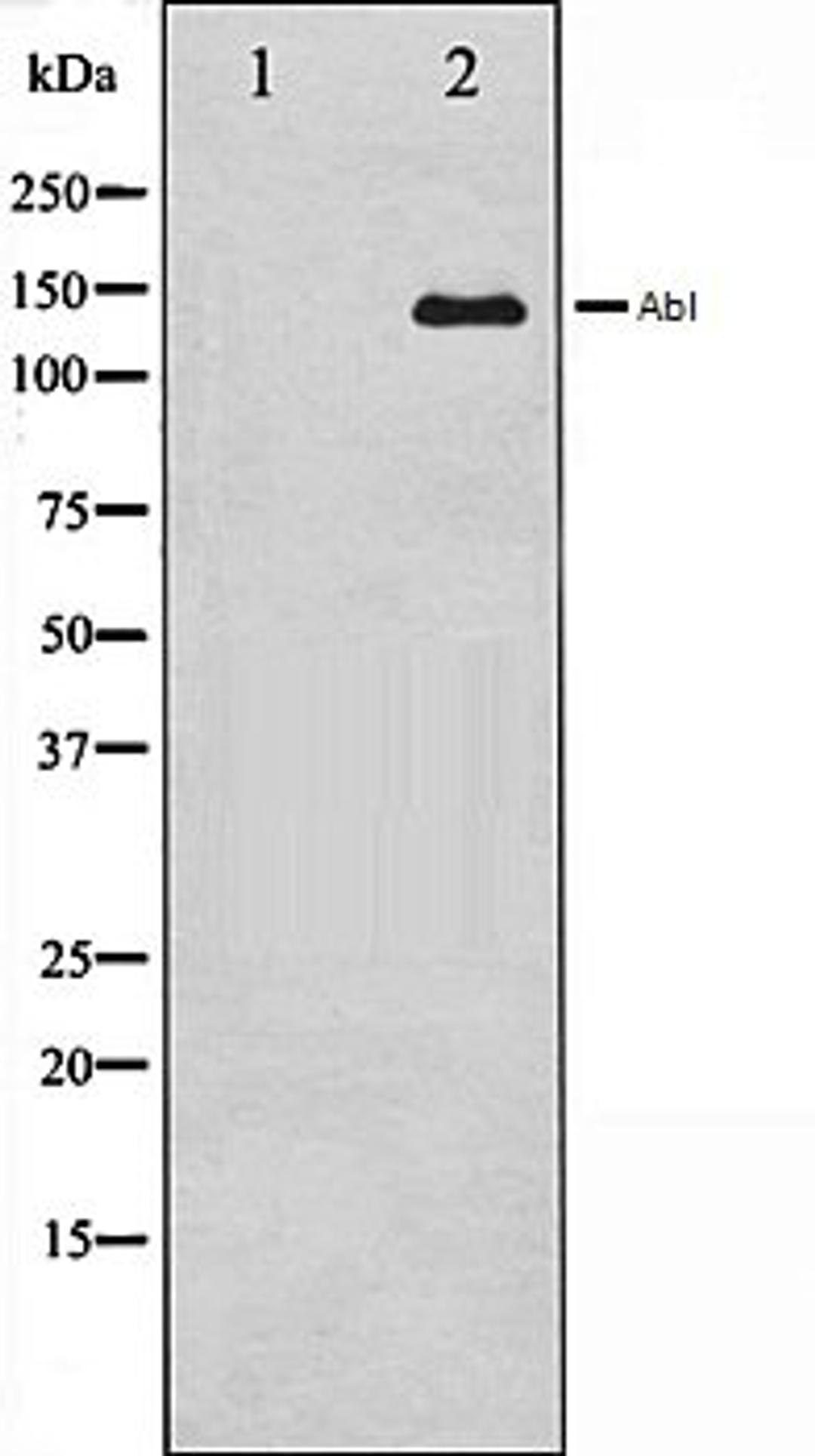 Western blot analysis of COS7 whole cell lysates using Abl antibody, The lane on the left is treated with the antigen-specific peptide.