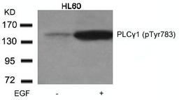 Western blot analysis of lysed extracts from HL60 cells untreated or treated with EGF using PLC&#947;1 (Phospho-Tyr783).