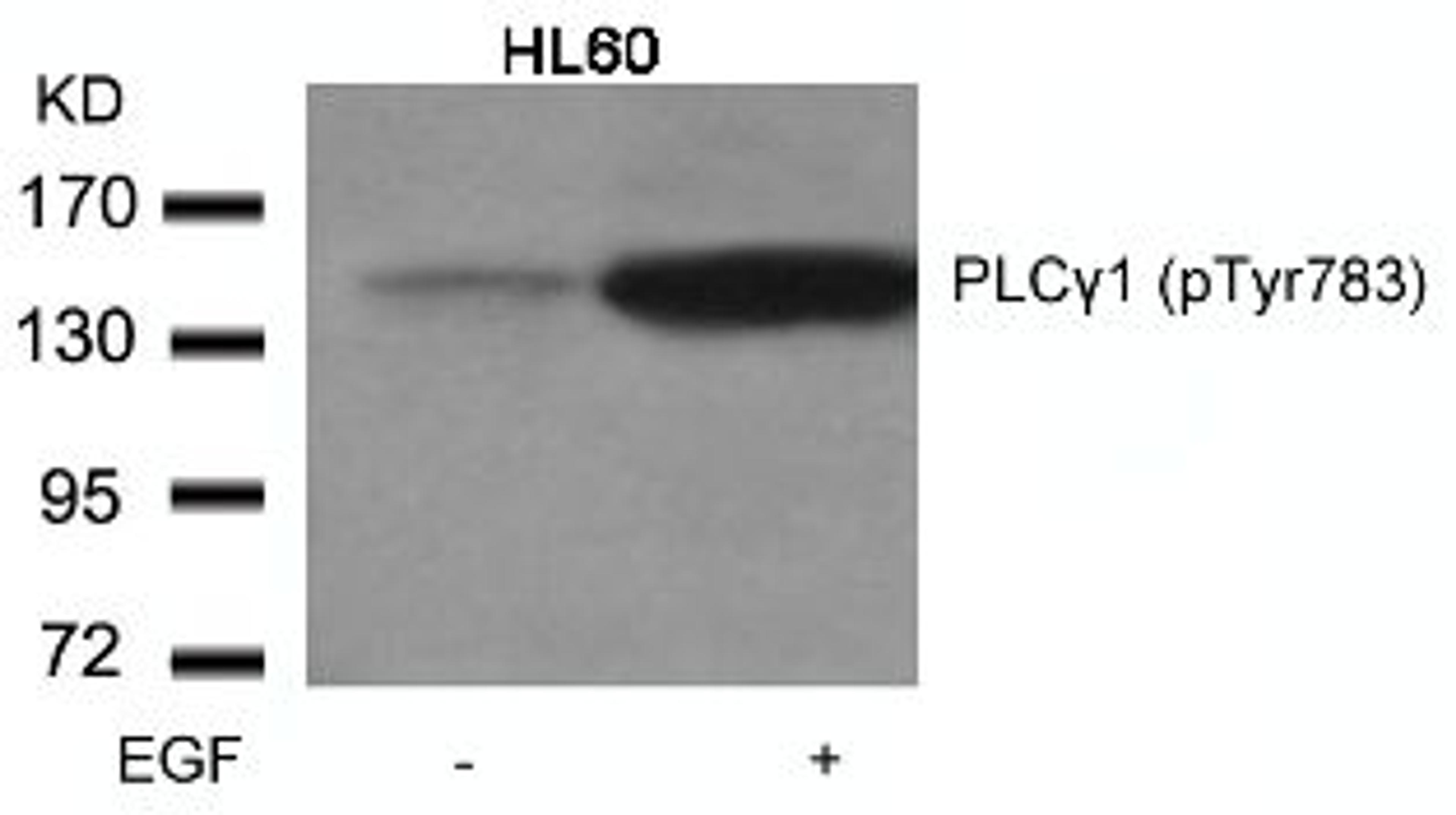 Western blot analysis of lysed extracts from HL60 cells untreated or treated with EGF using PLC&#947;1 (Phospho-Tyr783).