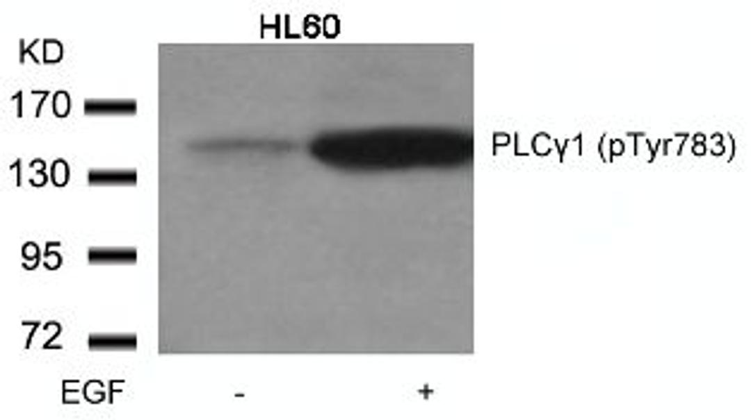Western blot analysis of lysed extracts from HL60 cells untreated or treated with EGF using PLCγ1 (Phospho-Tyr783).