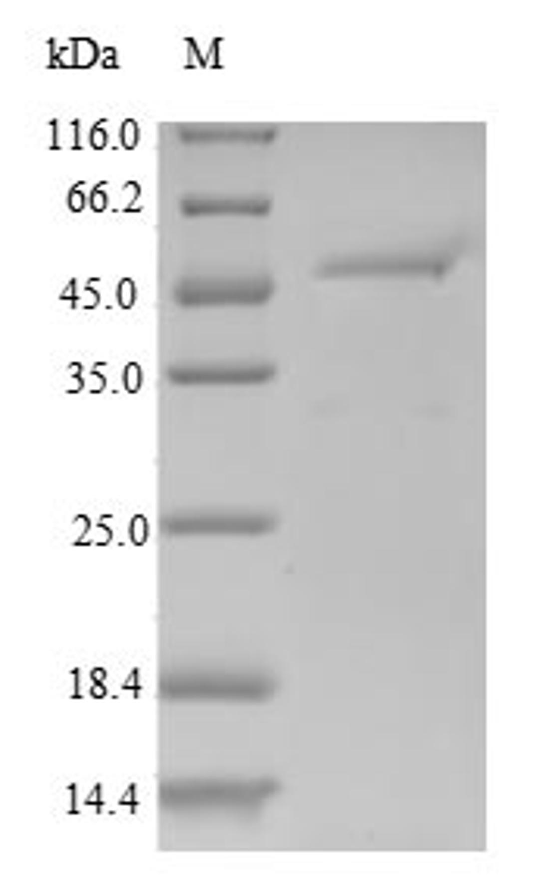 (Tris-Glycine gel) Discontinuous SDS-PAGE (reduced) with 5% enrichment gel and 15% separation gel.