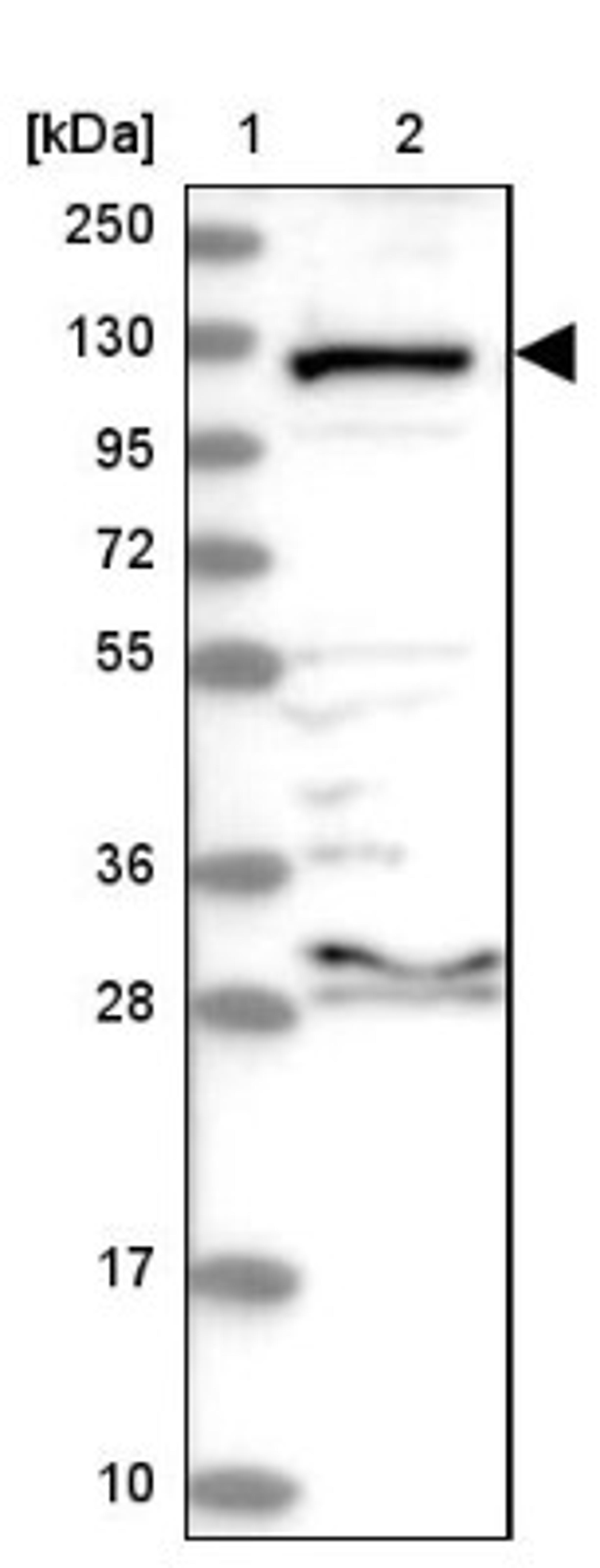 Western Blot: Aminopeptidase LRAP/ERAP2 Antibody [NBP2-37872] - Lane 1: Marker [kDa] 250, 130, 95, 72, 55, 36, 28, 17, 10<br/>Lane 2: RT-4