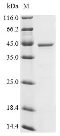 (Tris-Glycine gel) Discontinuous SDS-PAGE (reduced) with 5% enrichment gel and 15% separation gel.