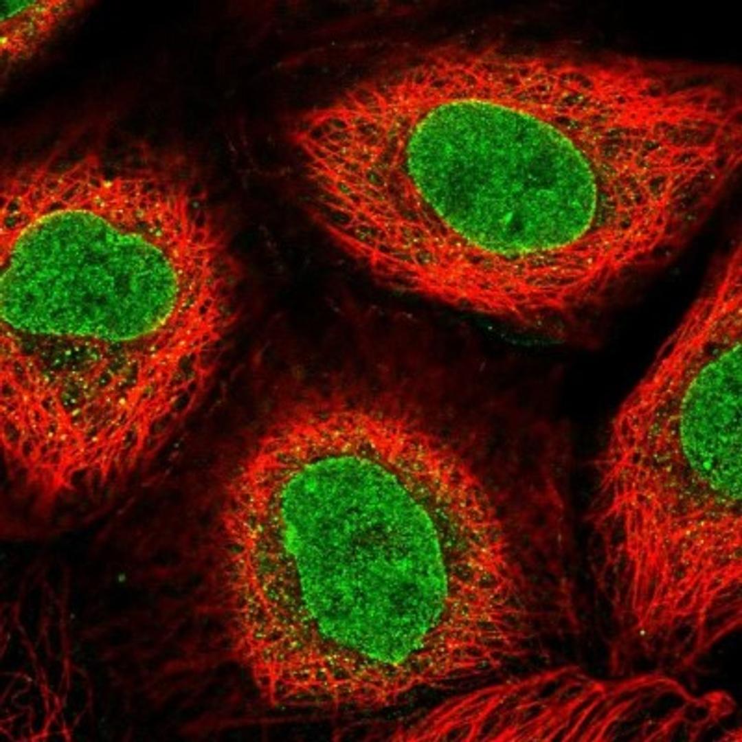 Immunocytochemistry/Immunofluorescence: AKD1 Antibody [NBP2-33936] - Immunofluorescent staining of human cell line A-431 shows positivity in nuclear membrane & nucleus but excluded from the nucleoli.