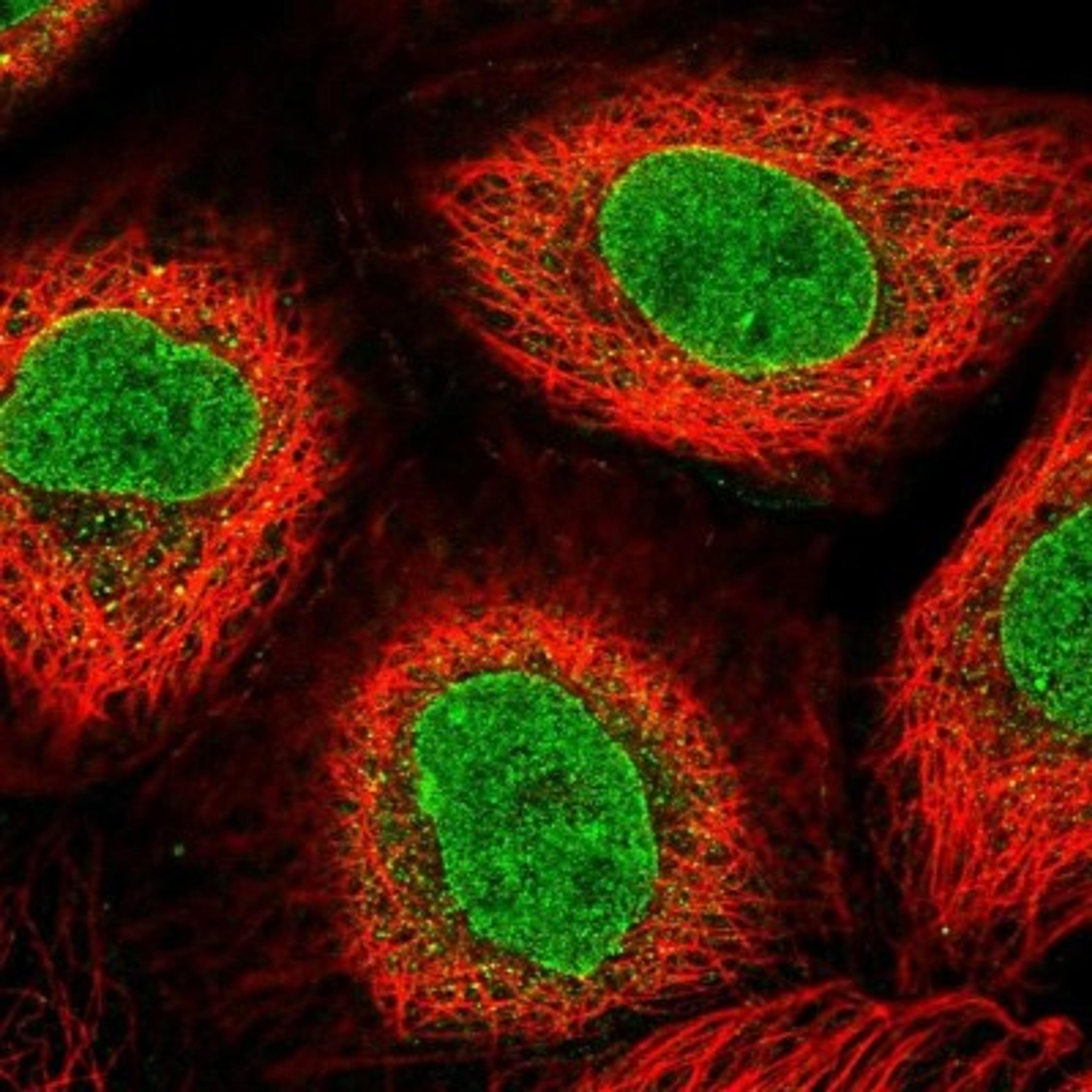 Immunocytochemistry/Immunofluorescence: AKD1 Antibody [NBP2-33936] - Immunofluorescent staining of human cell line A-431 shows positivity in nuclear membrane & nucleus but excluded from the nucleoli.