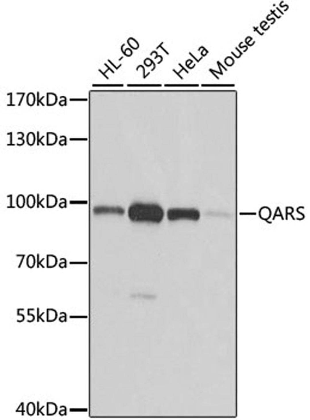 Western blot - QARS antibody (A6960)