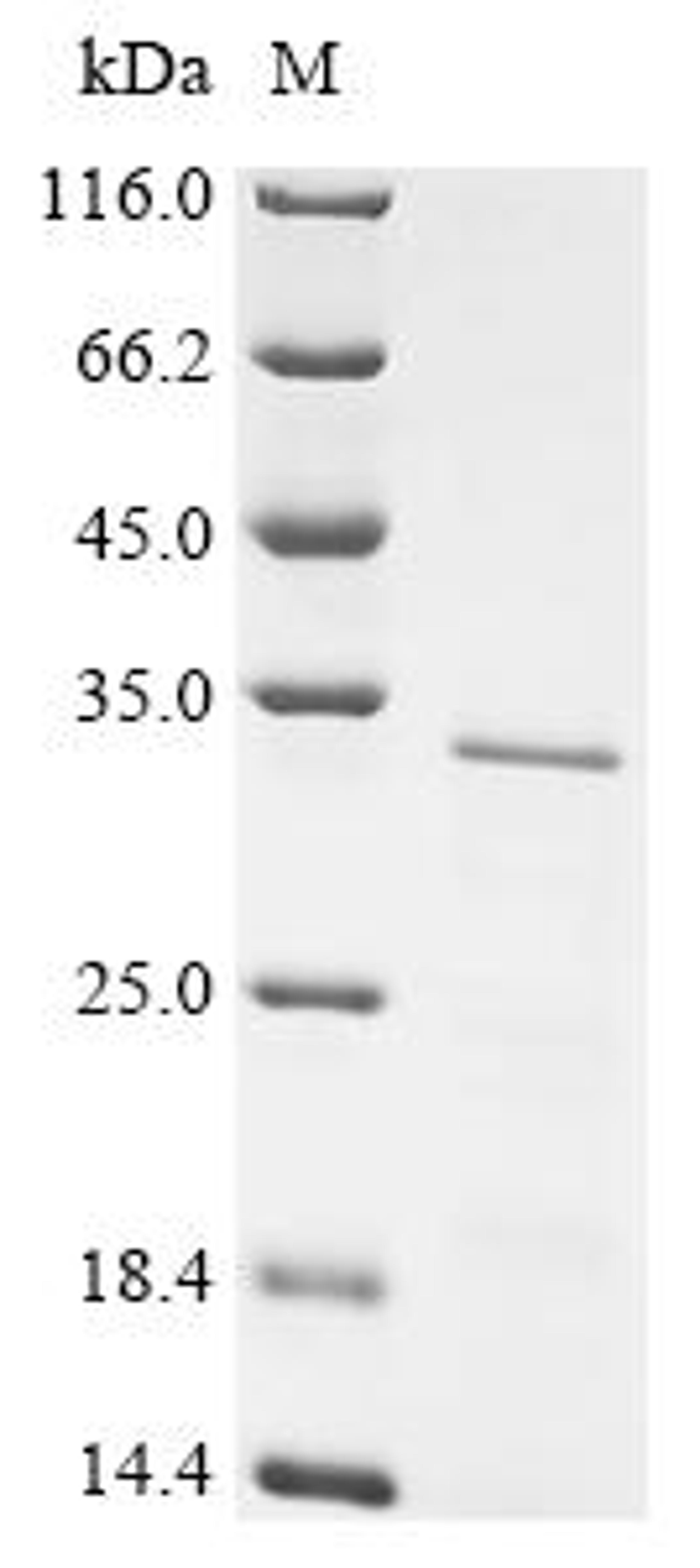(Tris-Glycine gel) Discontinuous SDS-PAGE (reduced) with 5% enrichment gel and 15% separation gel.