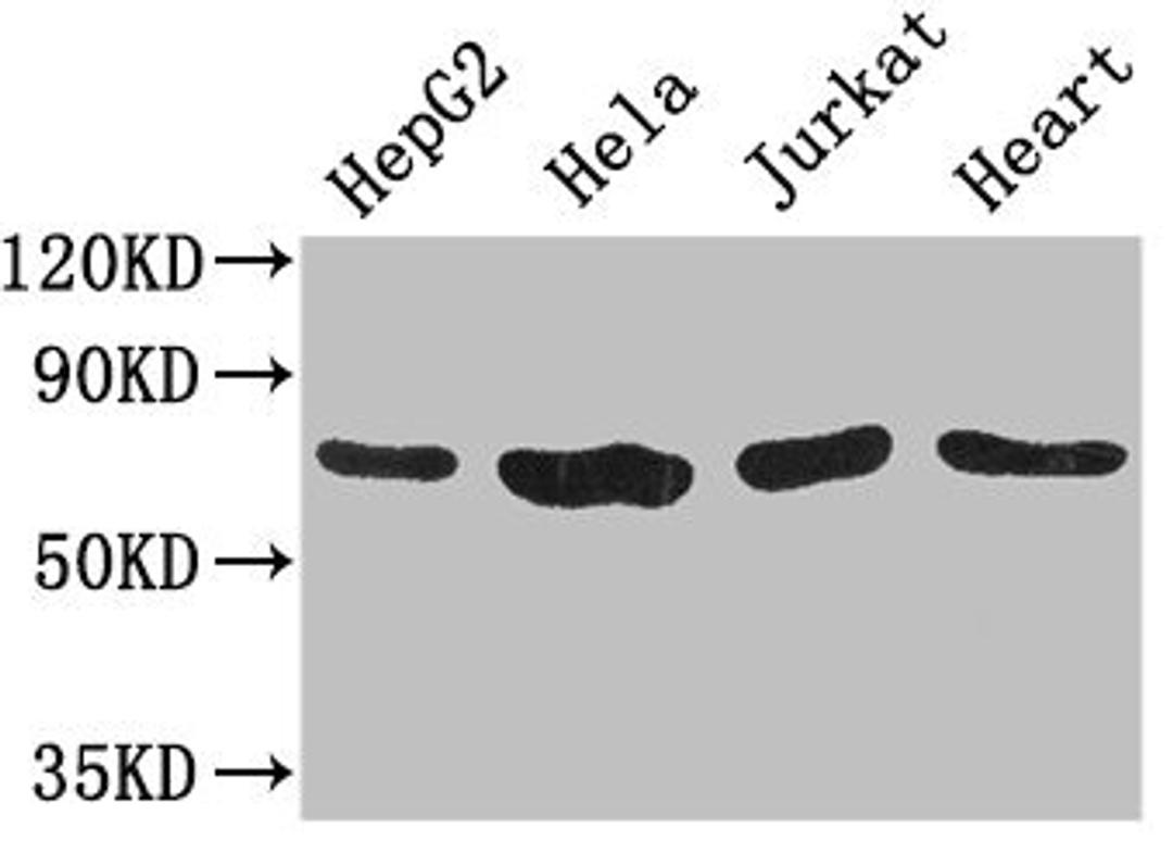 Western Blot. Positive WB detected in: HepG2 whole cell lysate, Hela whole cell lysate, Jurkat whole cell lysate, Mouse heart tissue. All lanes: CHFR antibody at 3.2ug/ml. Secondary. Goat polyclonal to rabbit IgG at 1/50000000 dilution. Predicted band size: 74, 73, 70, 64 kDa. Observed band size: 74 kDa.